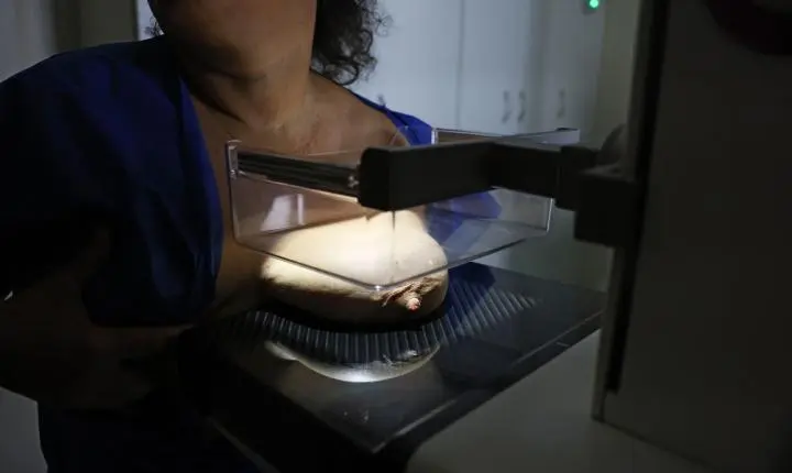 ANS defende que plano cubra mamografia digital sem restrição de idade