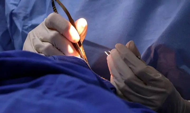 Tabela SUS Piracicabana aumenta oferta de cirurgias e exames para reduzir filas na saúde